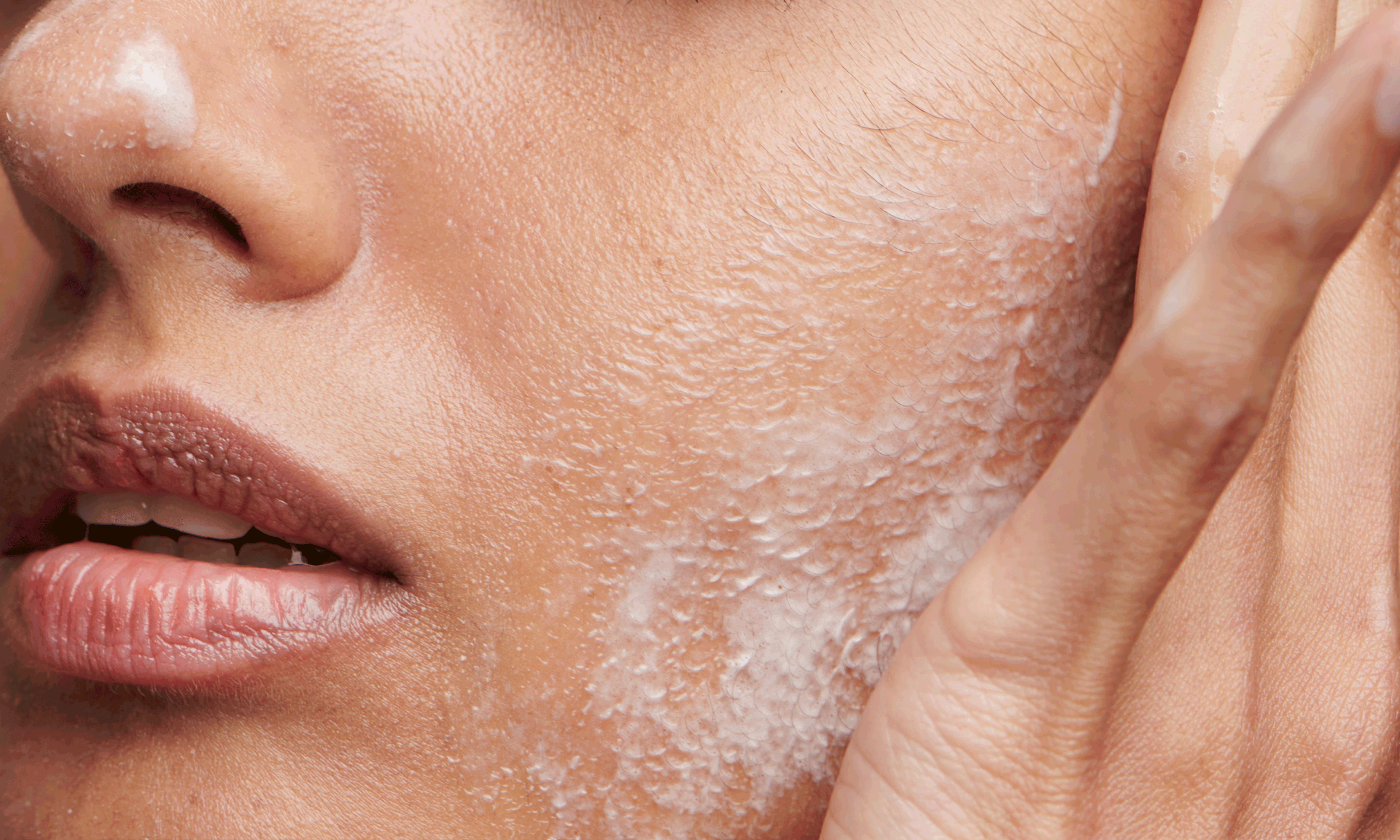 How to Take Care of Sensitive Skin: 6 Derm-Approved Tips