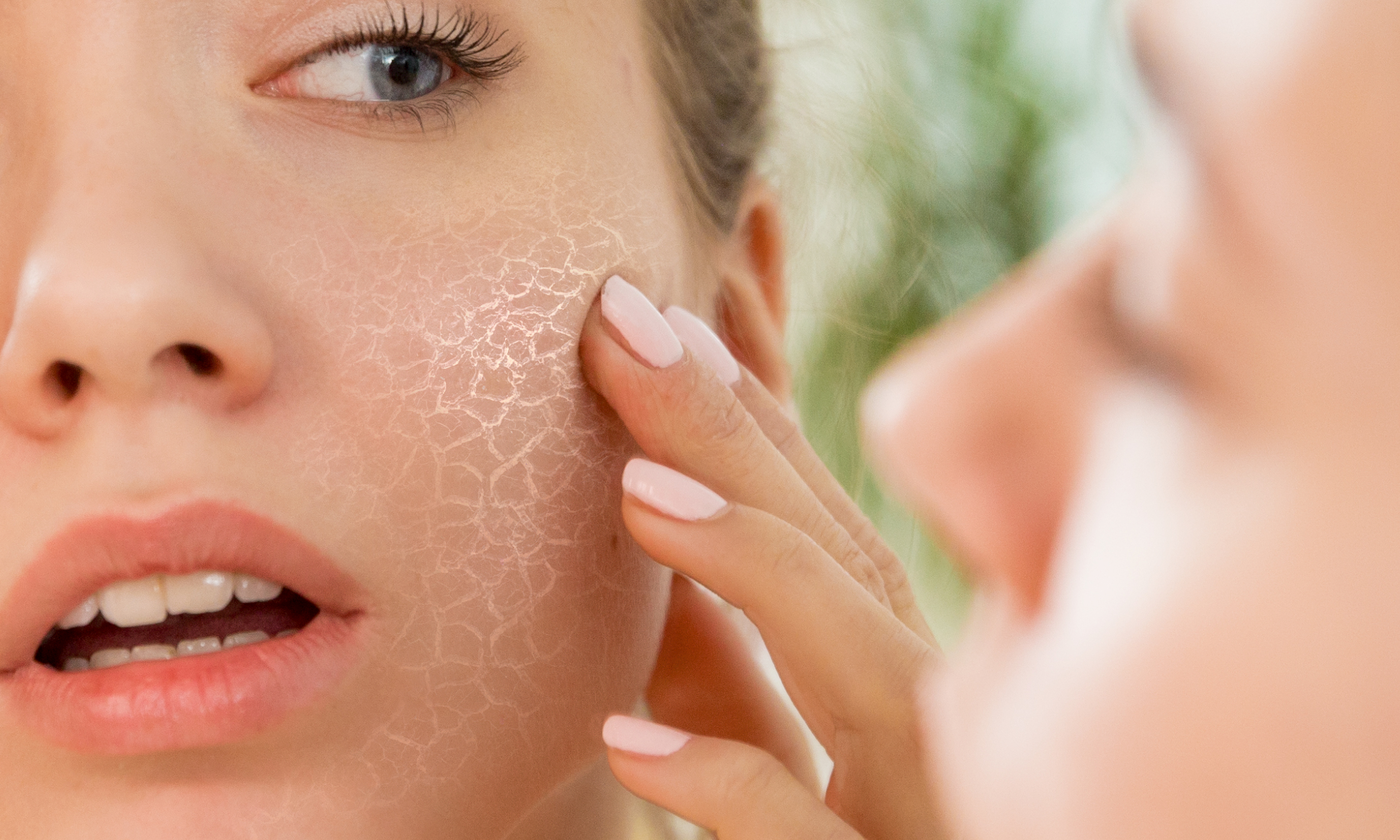 Skin Purging: The Ultimate Guide